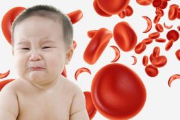 Bệnh thiếu máu não ở trẻ em là gì?